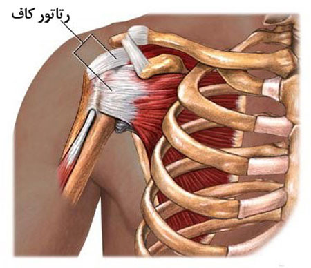 آیا تزریق پی ار پی می‌تواند به آسیب رتاتور کاف کمک کند؟