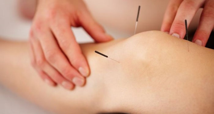 دیگر کاربردهای طب سوزنی