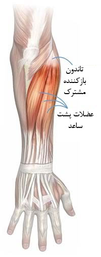 علت ابتلا به عارضه تنیس البو چیست؟