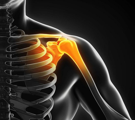 پارگی لابروم شانه به علت صدمه به غضروف در ورزش های سنگین و تصادف