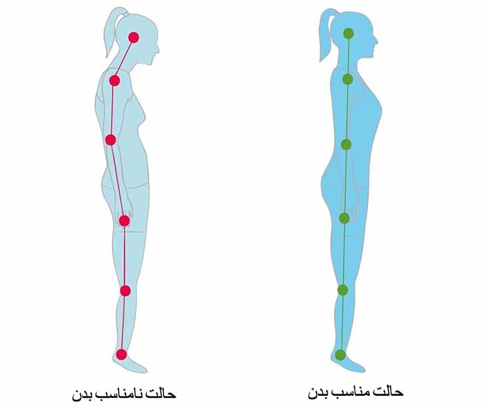 وضعیت بدن در حالت ایستاده