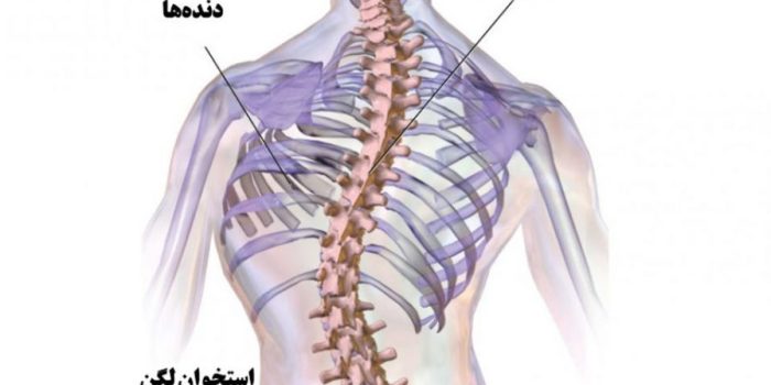 انحنای غیر عادی ستون فقرات