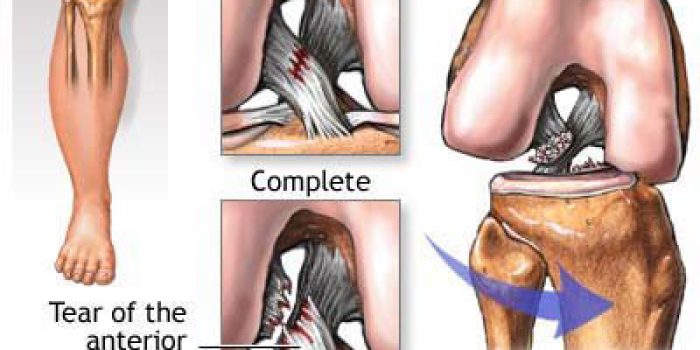 06_Knee-Injury_[www_Slam_ir]