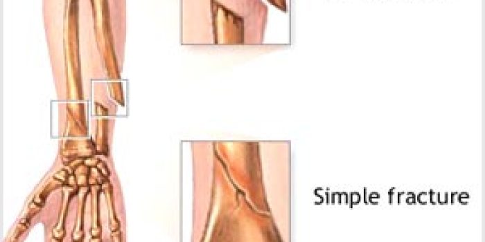 1126ef4062b49d22806514c9ead04300