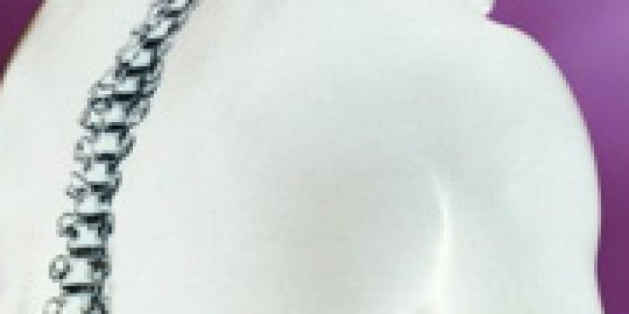 134215158175922191142031486317210514122015873