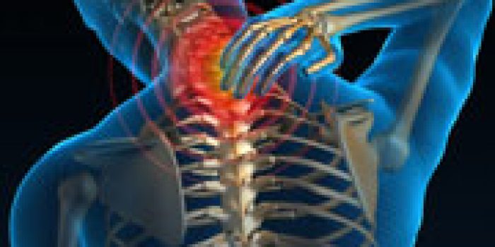 آرتروز گردن