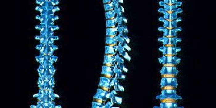 ستون فقرات, صدمات ستون فقرات , بهترین حالت کمر در موقع خوابیدن