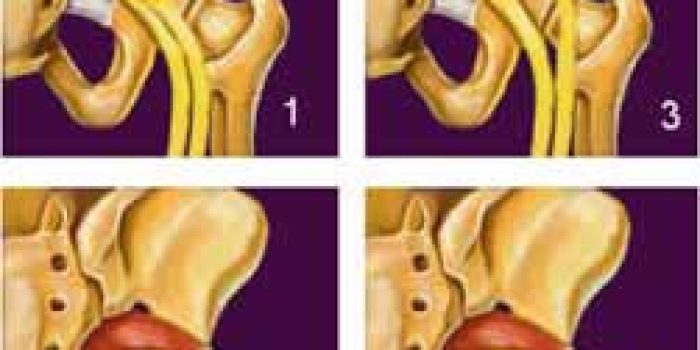 آسیب های لگن, درد در ناحیه لگن, علل درد در ناحیه لگن