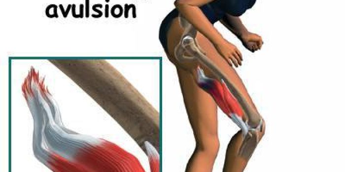 38292283265850022397