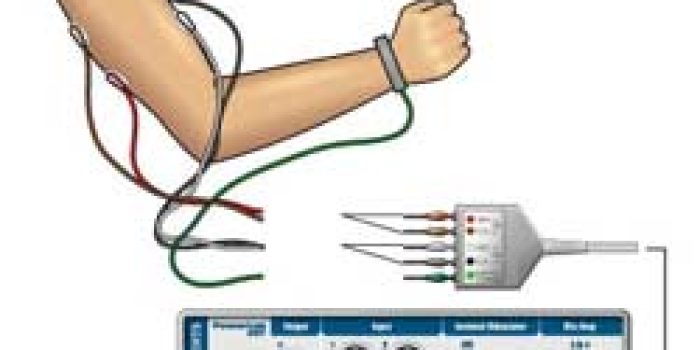 الکترومیوگرافی