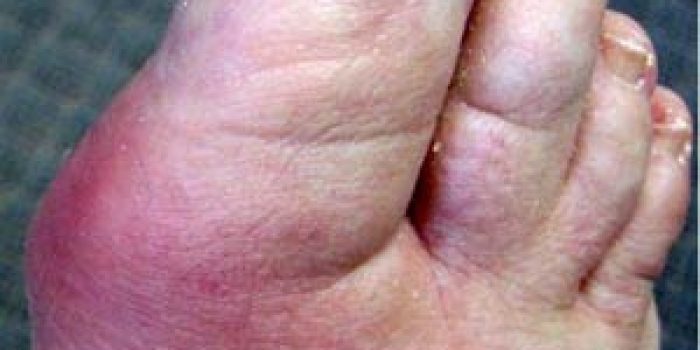 6ff0d05249ad0460e32f77f417a2b2ff