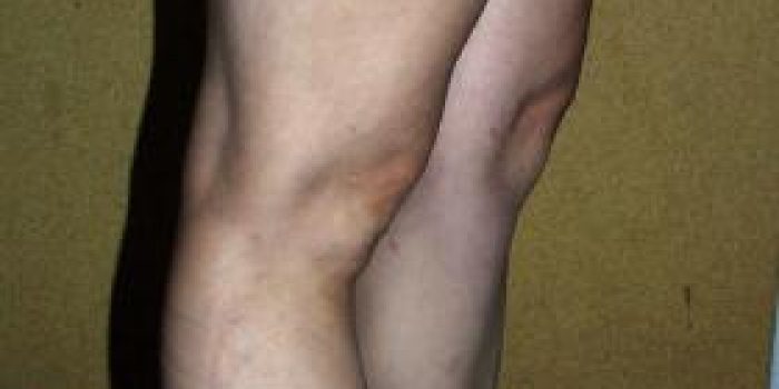 72987110548460392080