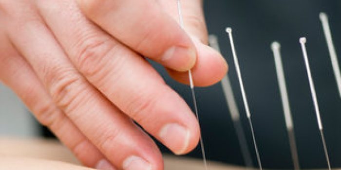 طب سنتی ,دردهای ستون فقرات, طب سوزنی