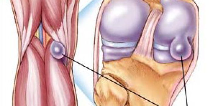 886501211b054d021fc0ba7f99931748popliteal01