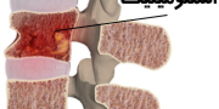 992331342422061671971691635718825114025122530