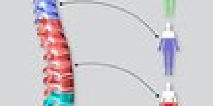 C0081619-Spinal_injury