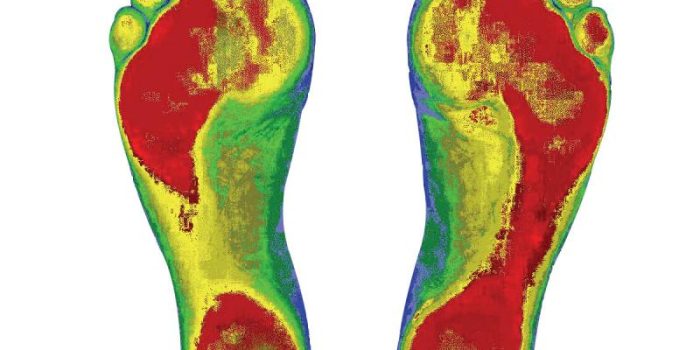 ColorFootScan_5152418_std