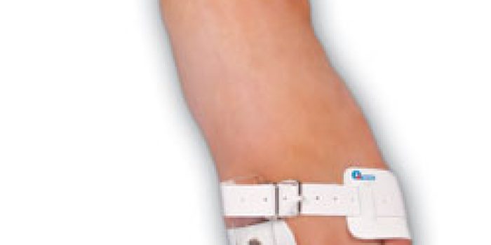 برجسته شدن شست پا, هالوکس والگوس