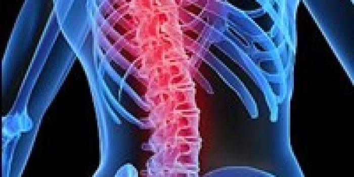 back-pain
