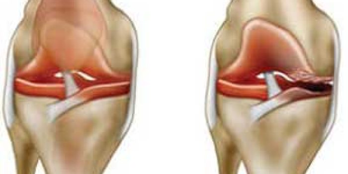 drfarkhani-170121120526