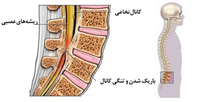 drfarkhani-170223130158