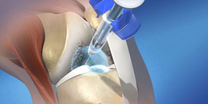 drfarkhani-170327100852