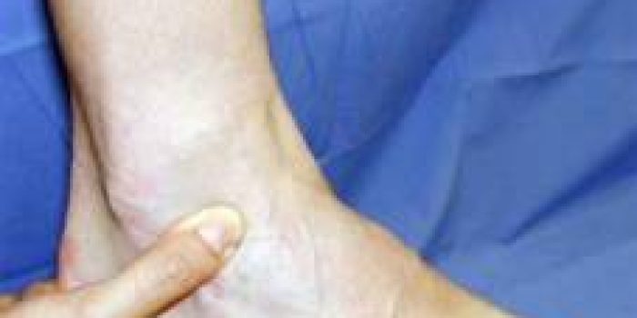 e4feaad0bb2b0fa9ddc049f01b16e182ankle_sprain