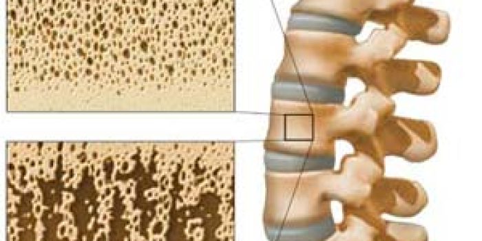 fdb00fe1189e3b3233b9242bf78c597a