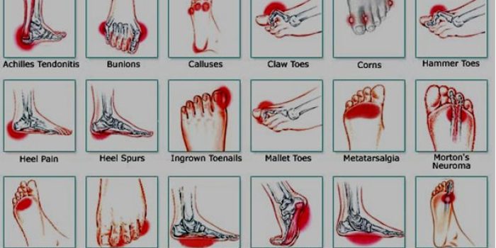 foot_related_problems