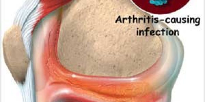 fx4ntjow2cxg5cthiwn0