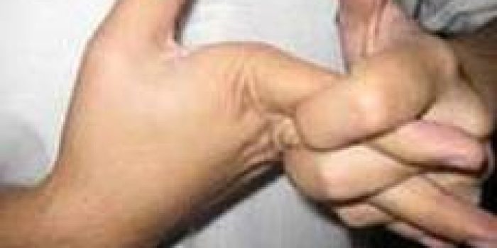 شکاندن انگشتان دست