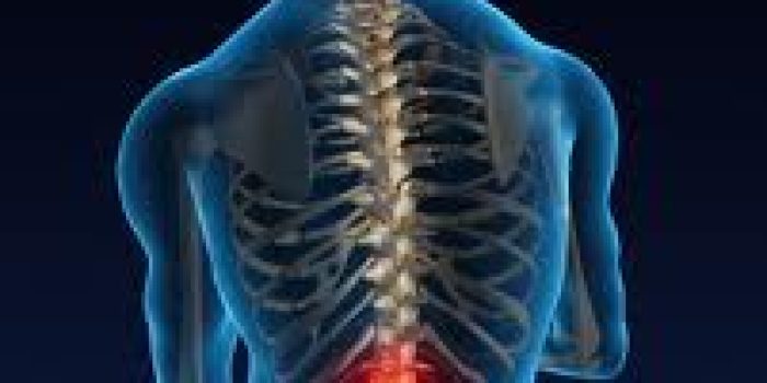 جراحی دیسک کمر