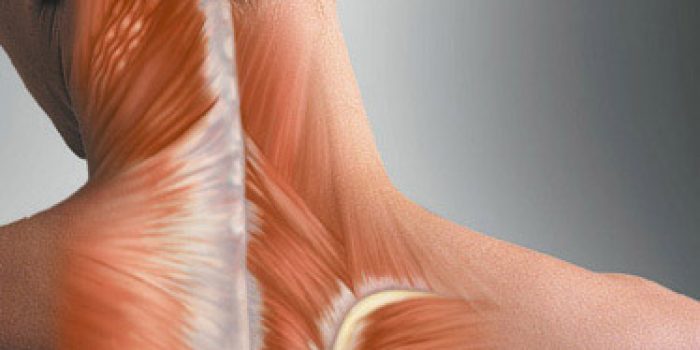 neck_spasm