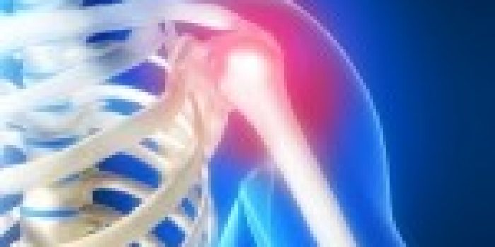 pain-shoulder-11042_02-150x150