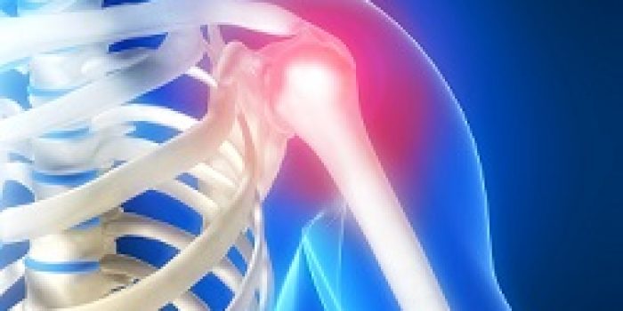 pain-shoulder-11042_0
