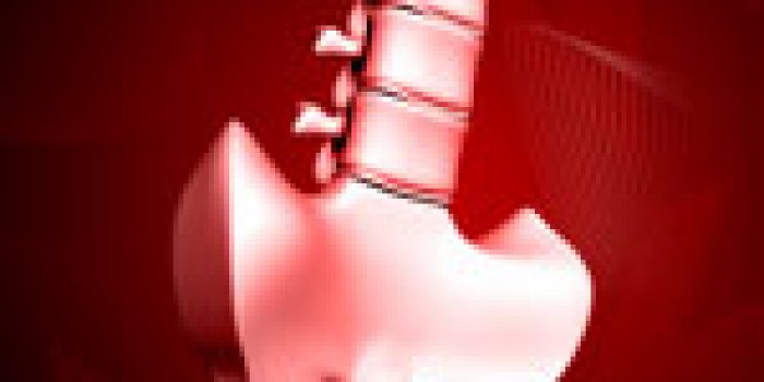 درد دنبالچه, علت درد دنبالچه, درمان درد در ناحیه دنبالچه