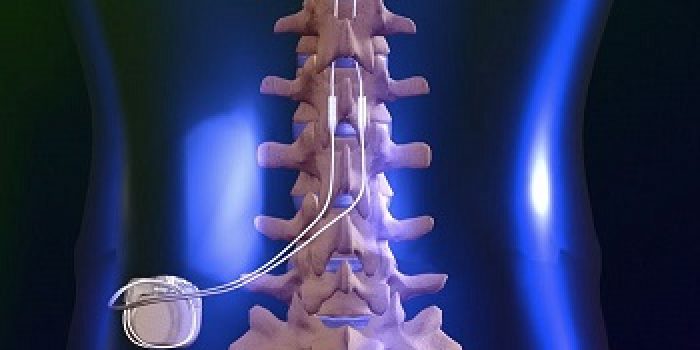 spinal-cord-stim