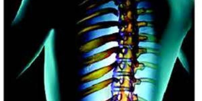 ستون فقرات, دردهای ستون فقرات, فیزیوتراپی در دردهای ستون فقرات