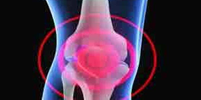 زانودرد , علل زانودرد, درمان زانو درد