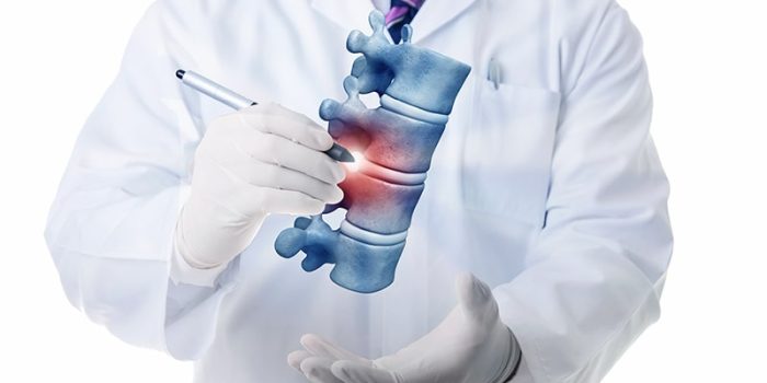 جراحی دیسککتومی کمر