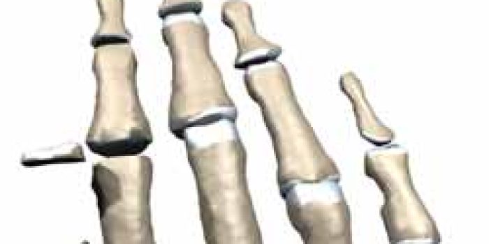 خشک شدن دست