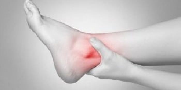 درد مچ پا