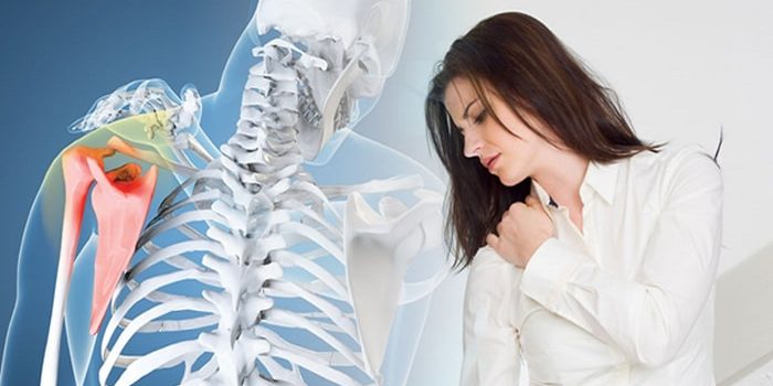 درمان صدا دادن مفصل شانه (استخوان کتف اسکاپولا) با فیزیوتراپی-