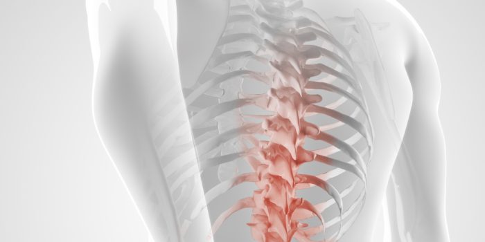 دیسک-کمر+سیاتیک