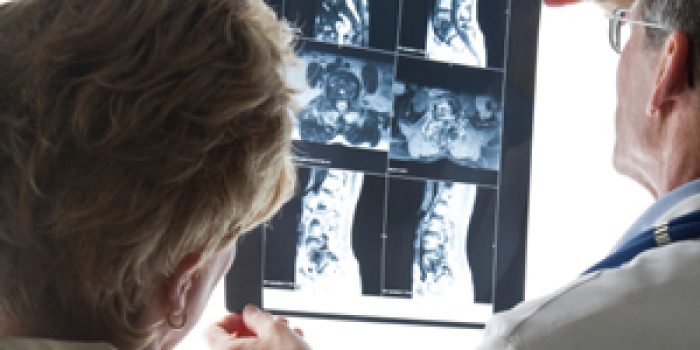 ستون-فقرات+6