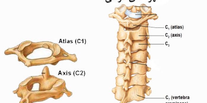 شکستگی-گردن