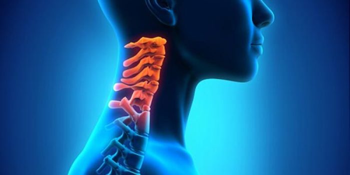 علت، علائم و درمان قطعی آرتروز گردن