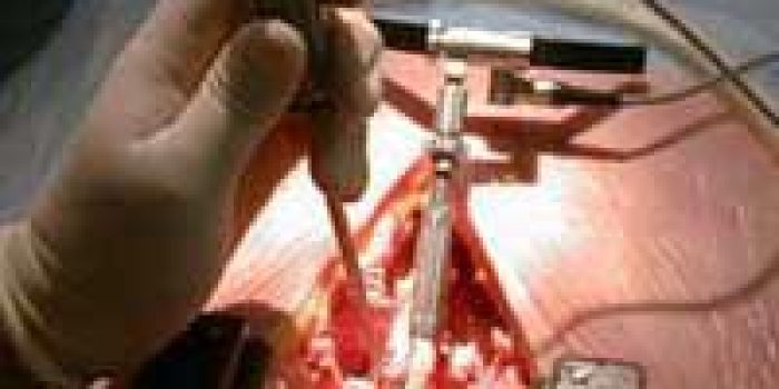 عمل ستون فقرات