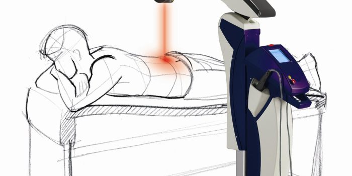 لیزر در عضلات