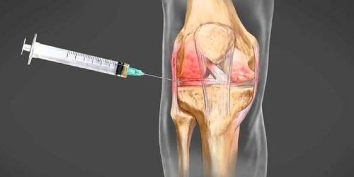 مزایای اوزون درمانی برای رفع دردهای مفصل، استخوان و ماهیچه